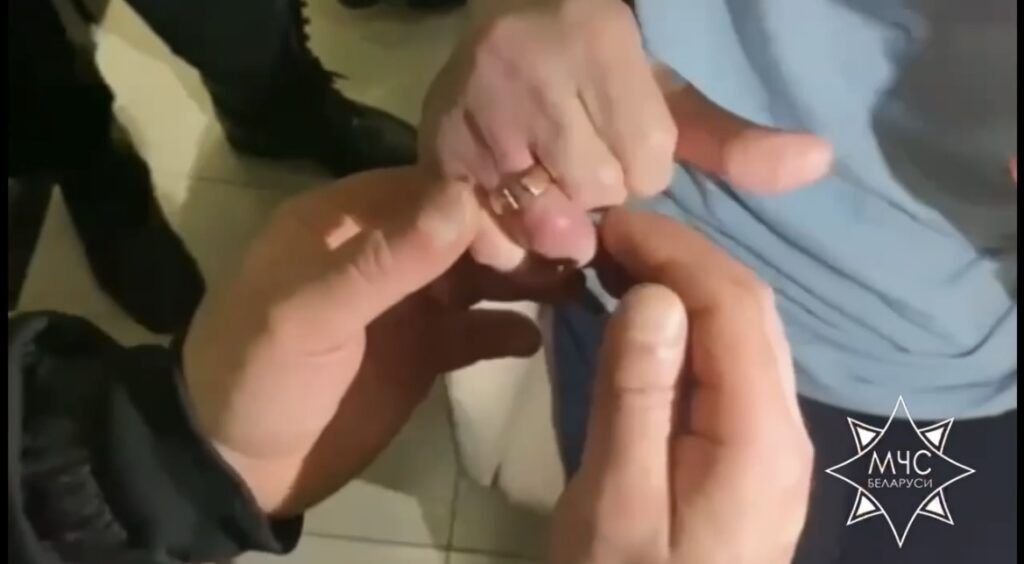 Спасатели Минского района помогли женщине. Её палец сдавливало кольцо