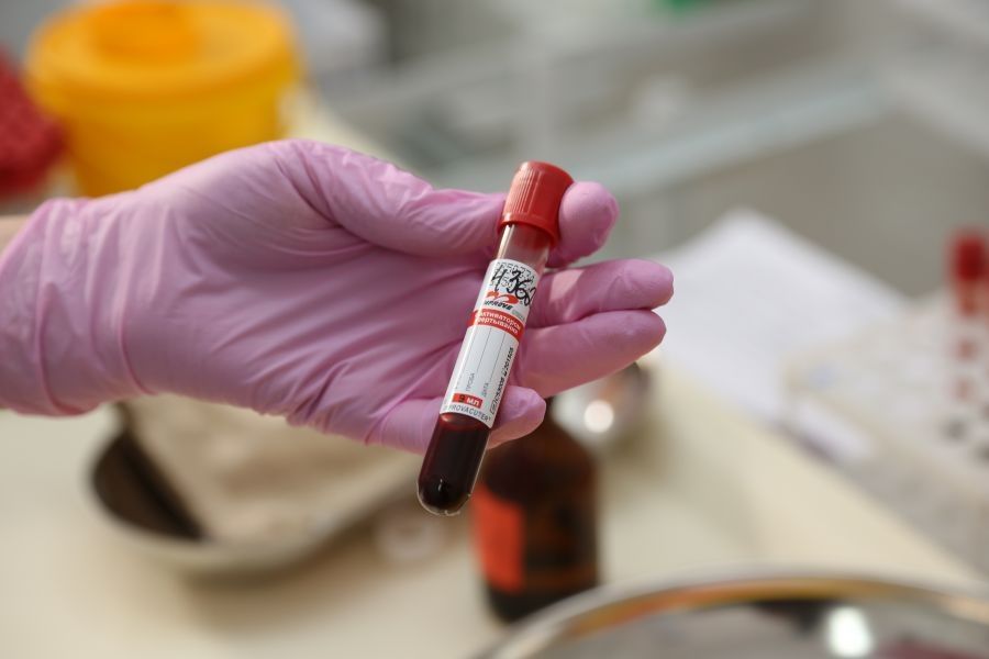 100% новых случаев ВИЧ в Минском районе выявили среди рабочих, ИП и служащих